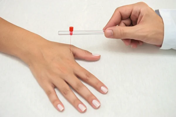 Kit Estesi�metro - monofilamentos semmes-weinstein